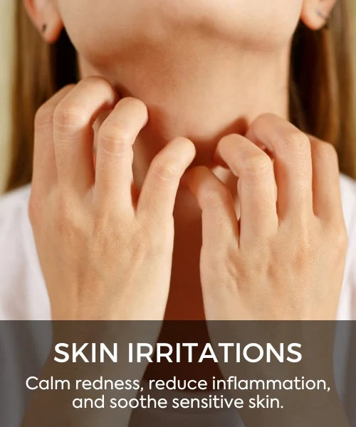 Skin Irritations